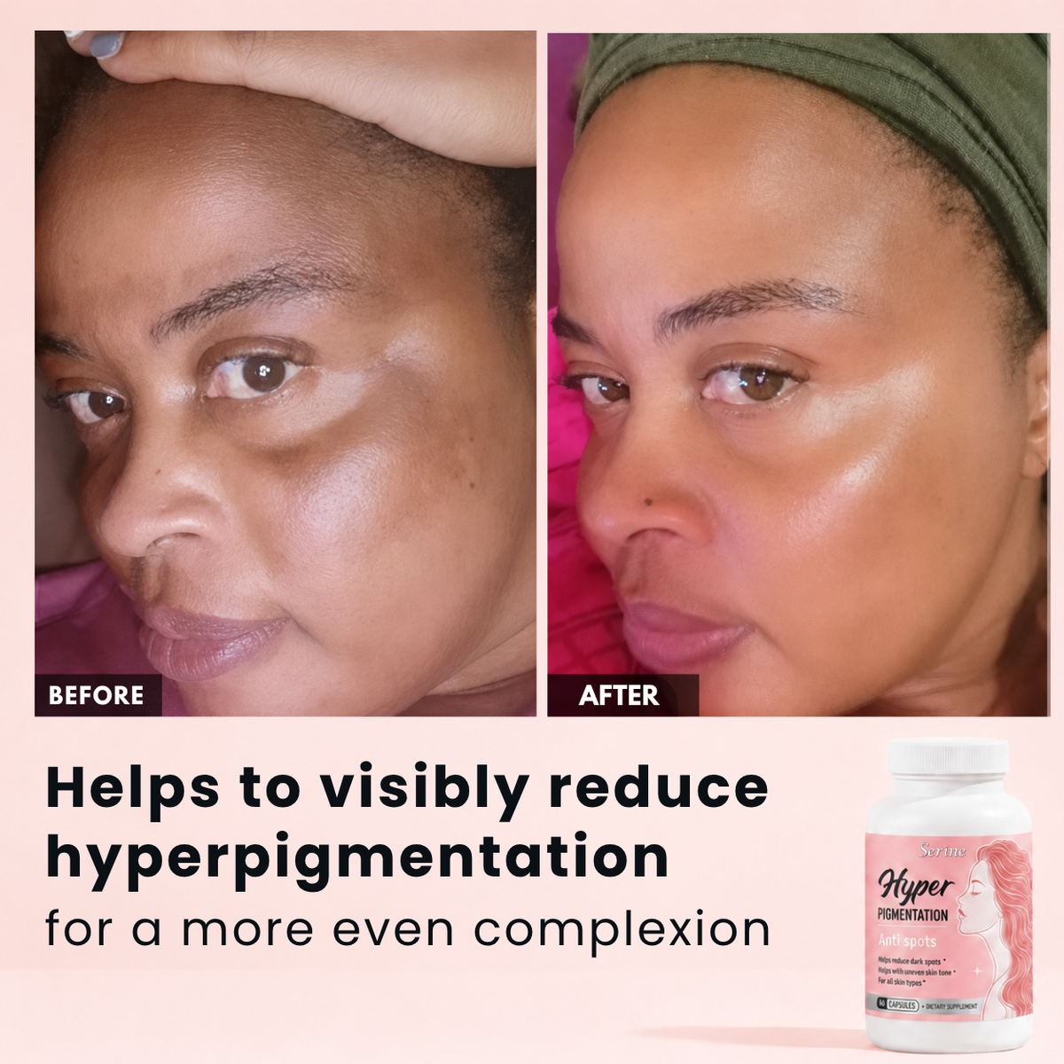 Anti Dark Spots Capsules
