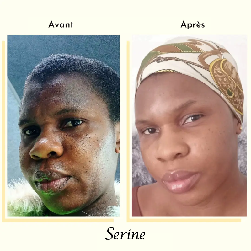 Chidima — before and after