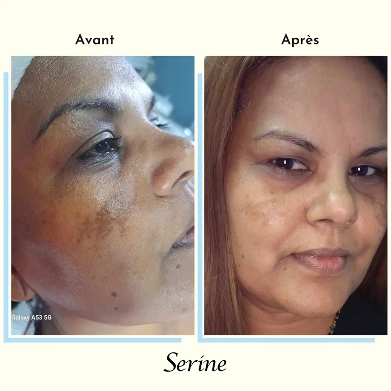 Chantal — before and after