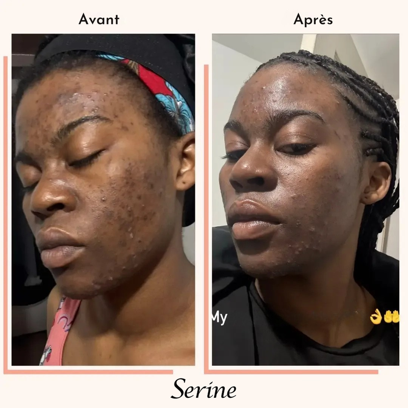 Fatou — before and after