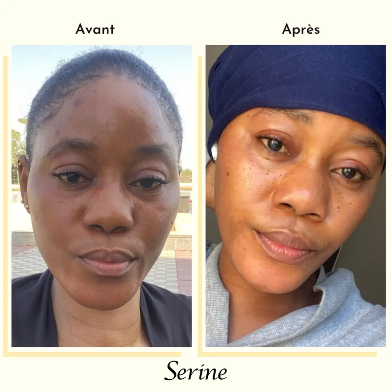Adjoua — before and after