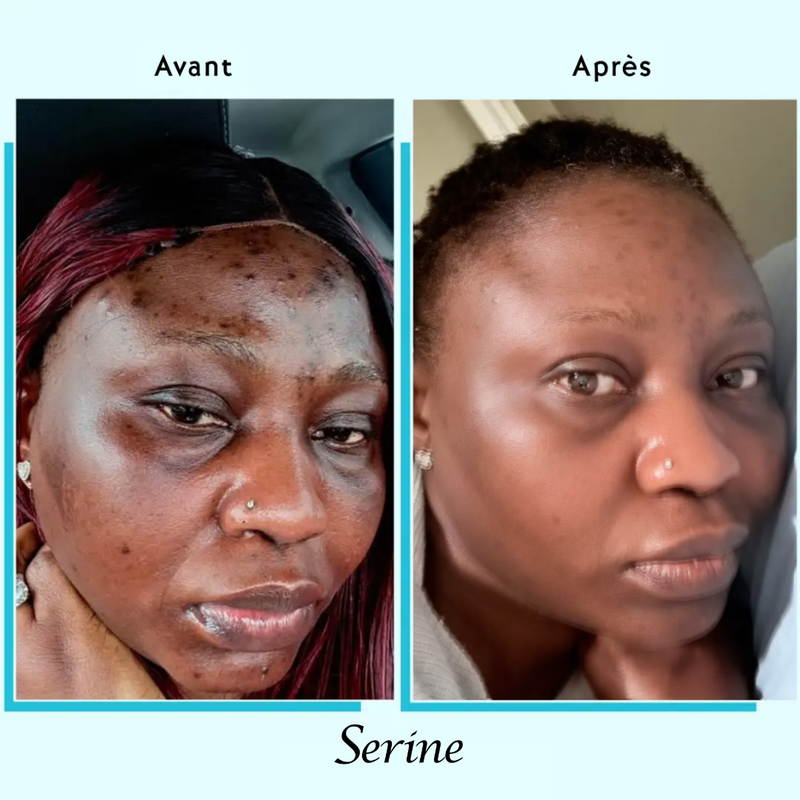 Rokhaya — before and after