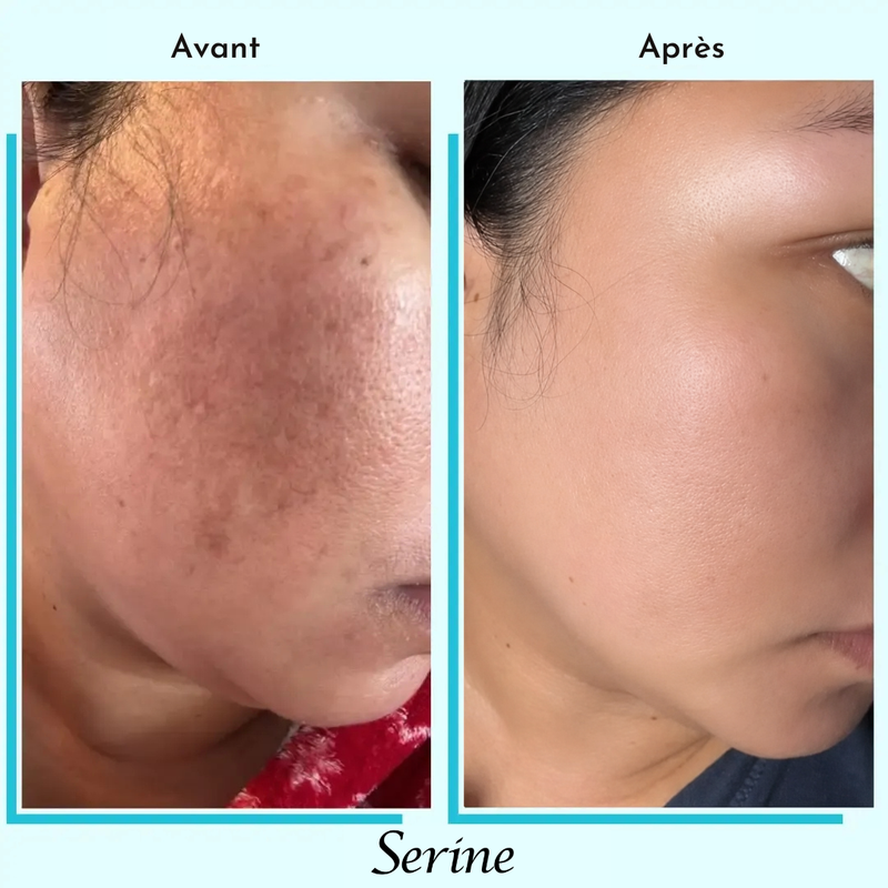 Nadège — before and after