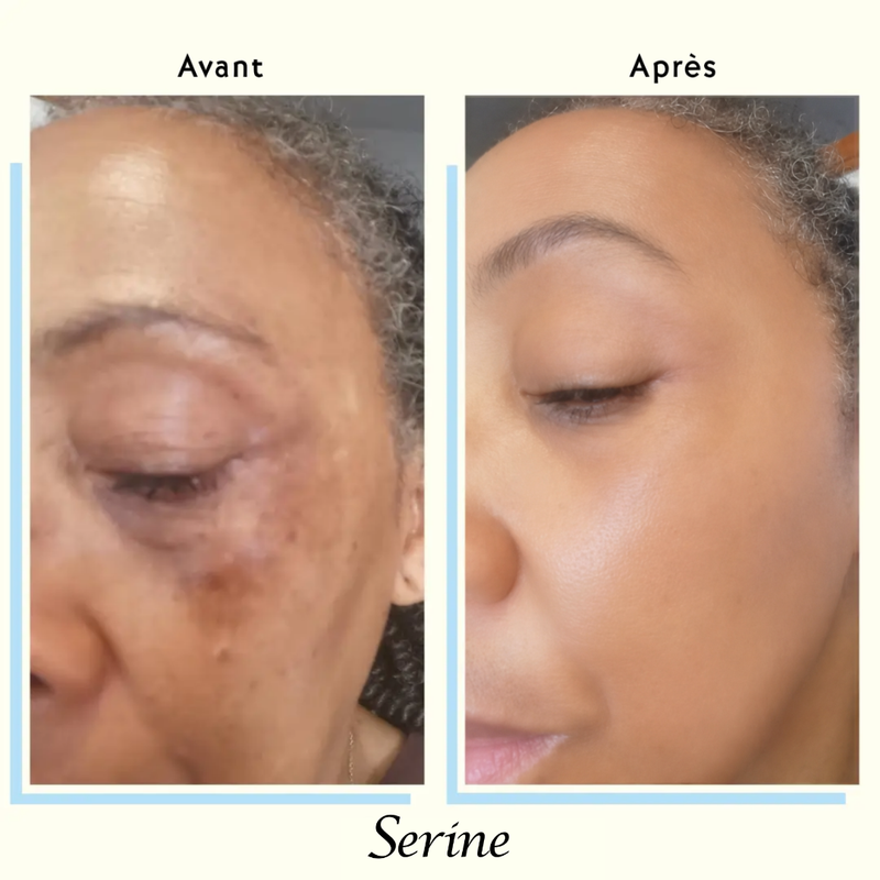 Customer — before and after