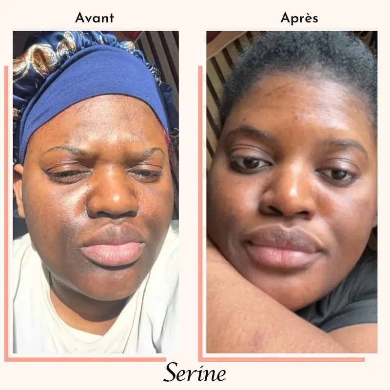 Amina — before and after