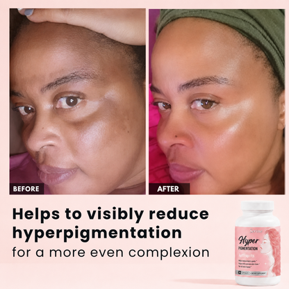 Anti Dark Spots Capsules