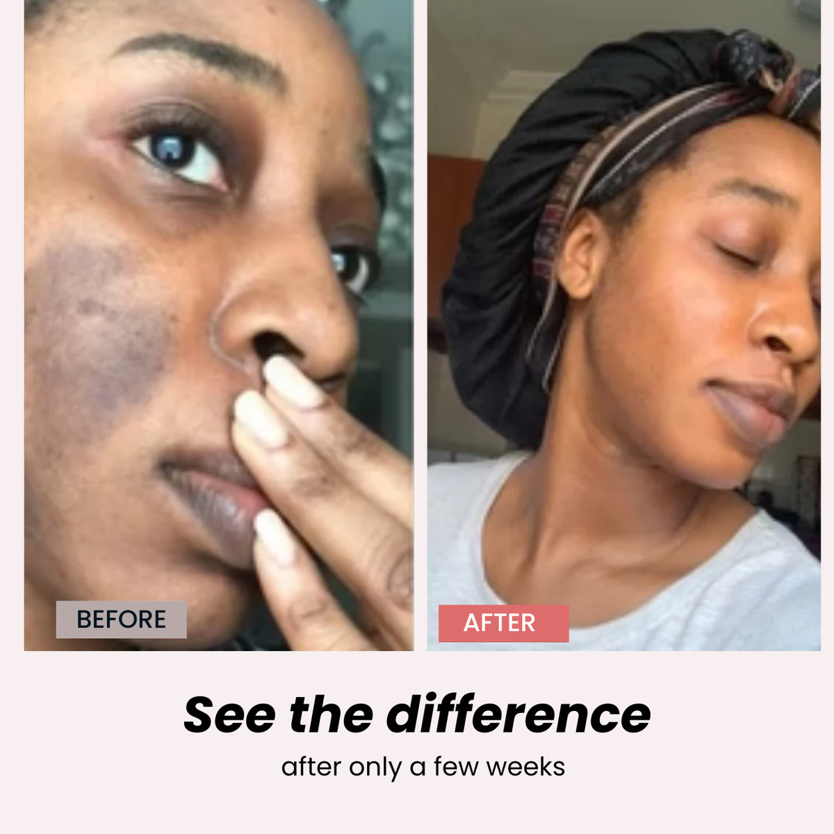 Anti Dark Spots Capsules