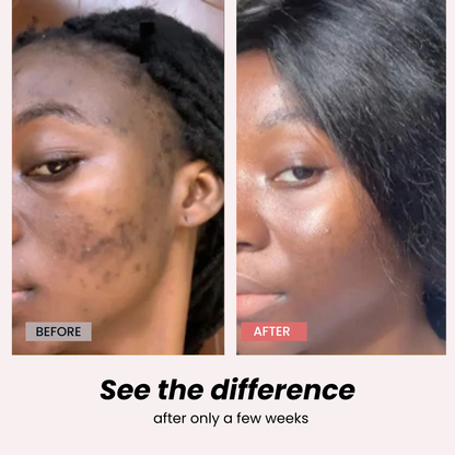 Anti Dark Spots Capsules